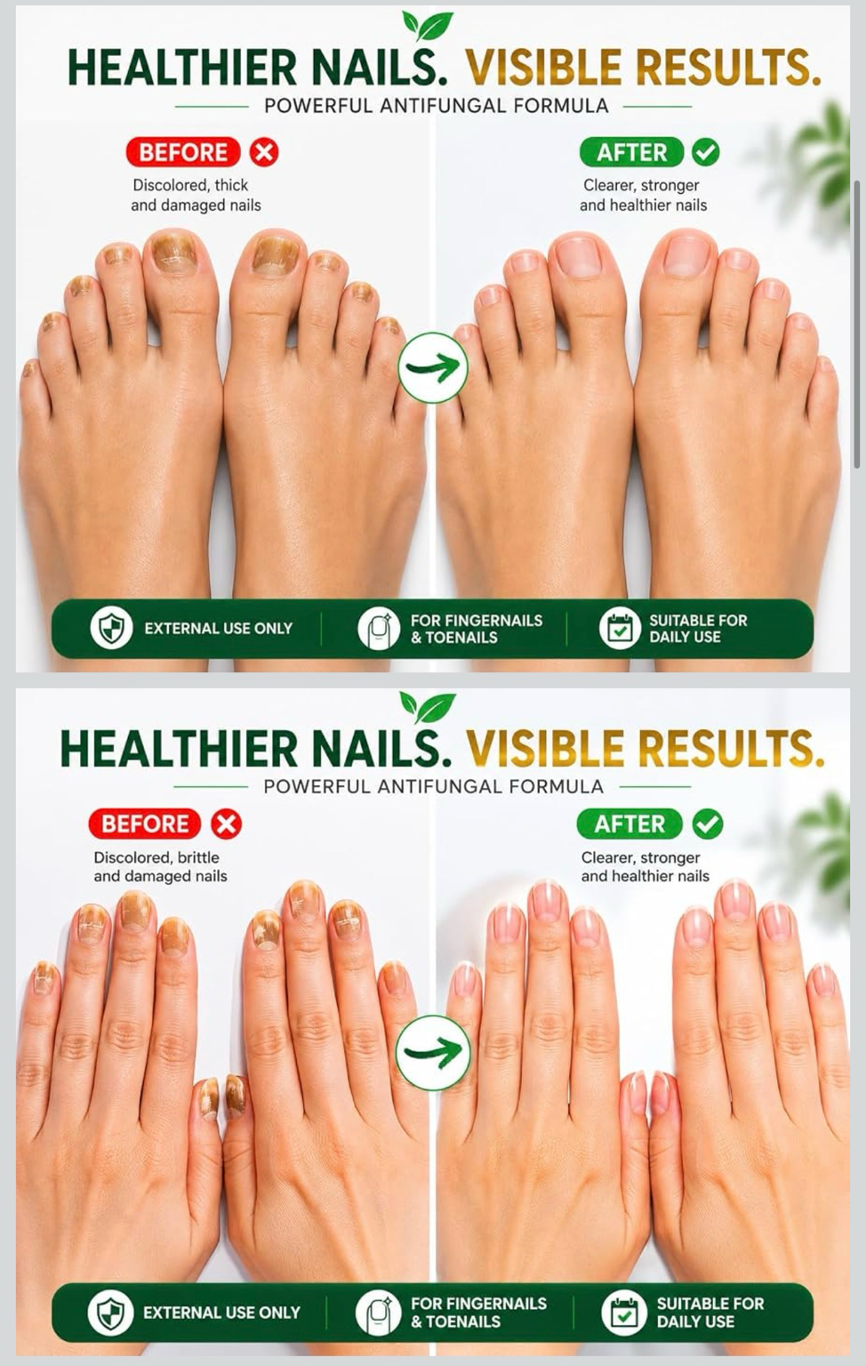 Oriundo Life Nail Fungus Away – Tratamiento Antifúngico para Uñas de Manos y Pies | 16 ml