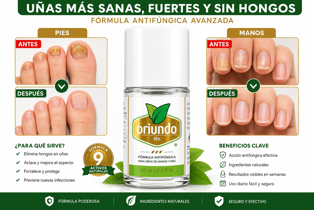 Oriundo Life Nail Fungus Away – Tratamiento Antifúngico para Uñas de Manos y Pies | 16 ml