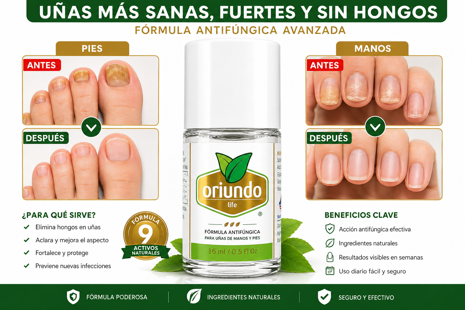 Oriundo Life Nail Fungus Away – Tratamiento Antifúngico para Uñas de Manos y Pies | 16 ml