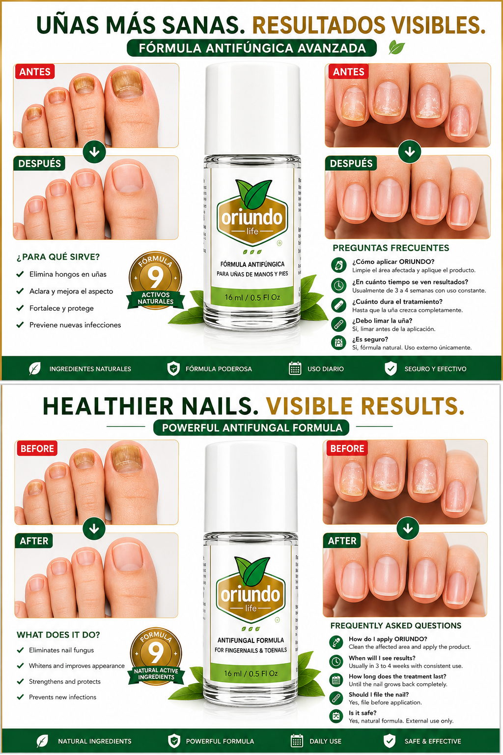 Oriundo Life Nail Fungus Away – Tratamiento Antifúngico para Uñas de Manos y Pies | 16 ml